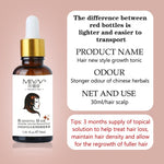 Anti Hair Loss Products Hair Growth Spray Essential Oil Liquid for Men Women Hair Growth Essence Serum Hair Care Repair Growing